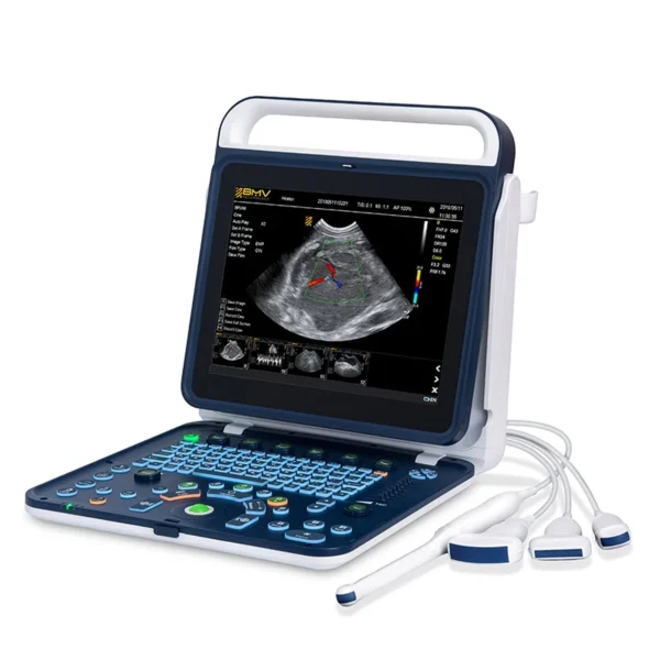 Échographe Doppler couleur portable BPU60